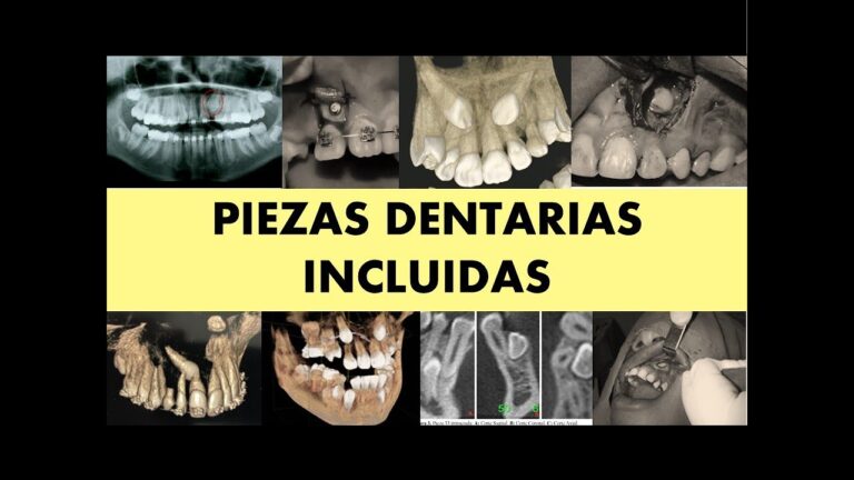 Opciones de Asesor&iacute;a Jur&iacute;dica Gratuita en Los Molares