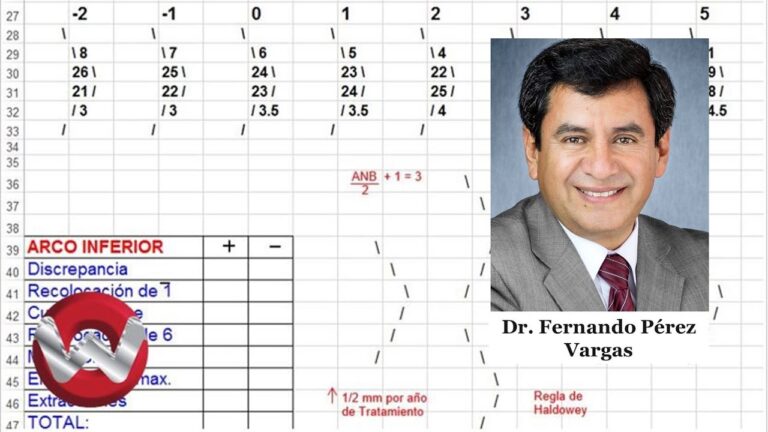 Clases de Ajedrez en Los Molares: Dónde Encontrarlas